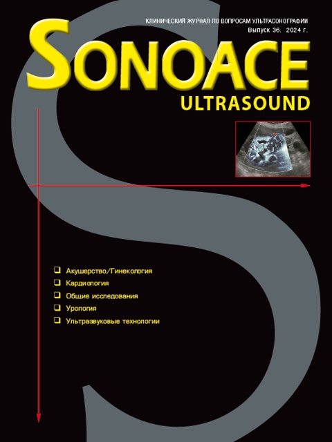 Журнал SonoAce-Ultrasound №36