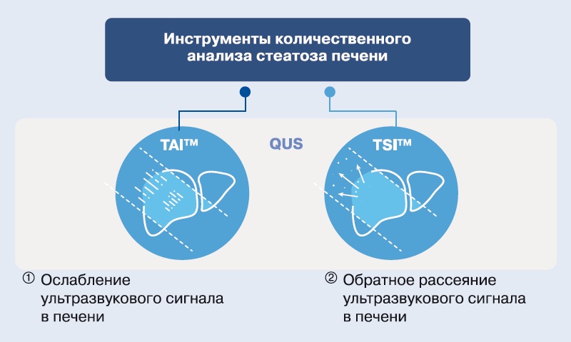 Схема: TAI и TSI - инструменты количественного анализа стеатоза печени