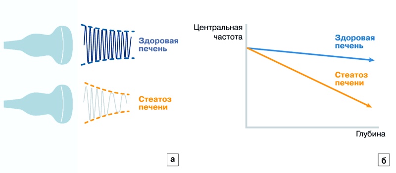 Схема: а - ослабление ультразвукового сигнала в здоровой печени и при стеатозе, б - сдвиг центральной частоты в зависимости от глубины