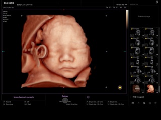 Fetal face, RealisticVue, 3D
